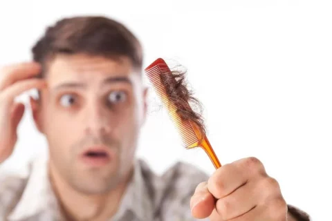 penyebab rambut rontok pada pria