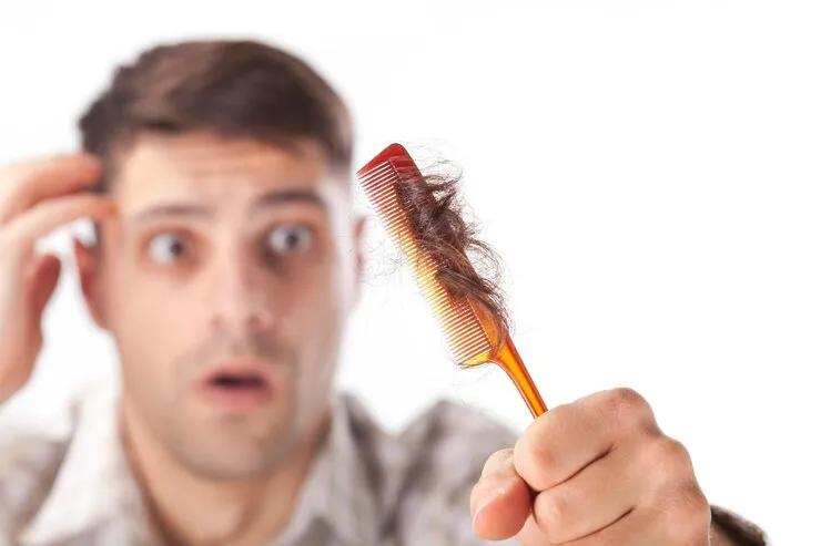 penyebab rambut rontok pada pria