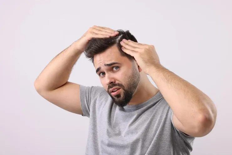 penyebab rambut rontok pada pria